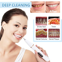 Load image into Gallery viewer, Ultrasonic Dental Cleaner Set Dental Calculus Scaler Electric Sonic Oral Teeth Tartar Remover Plaque Stains Cleaner Teeth Tool

