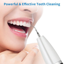 Load image into Gallery viewer, Sonic Tartar Calculus Remover Dental Scaler Tooth Cleaner Teeth Cleaning Machine Professional Stains Ultrasonic Tooth Cleaner
