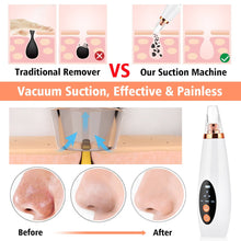 Load image into Gallery viewer, Facial Pore Cleaner Blackhead Remover Vacuum Suction Cleaner Pore Acne Pimple Extractor Removal Device Skin Care Beauty Tool
