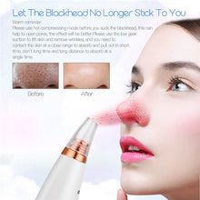 Load image into Gallery viewer, 6 In 1 Electric Facial Blackhead Remover Vacuum Suction Pore Removal Deep Cleaning Face Cleanser +Nano Facial Steamer Sprayer
