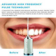 Load image into Gallery viewer, 240ML Oral Irrigator Portable Water Flosser Cleaning USB Rechargeable Dental Teeth Cleaner Water Jet Floss 4 Nozzles
