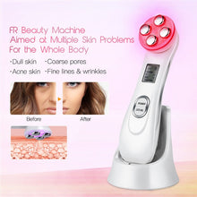 Load image into Gallery viewer, Facial Mesotherapy Electroporation RF Radio Frequency LED Photon Face Lifting Tighten Wrinkle Removal Skin Face Massager
