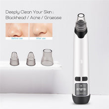 Load image into Gallery viewer, 4 In 1 Blackhead Remover Rechargeable Vacuum Suction Warmer Blackhead Acne Comedo Extractor Facial Cleanser Beauty Machine
