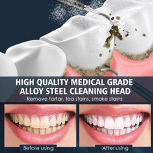 Load image into Gallery viewer, Electric Dental Scaler Teeth Whitening Device Teeth Cleaner Remove Dental Calculus Yellow Teeth Tartar Teeth Cleaning Oral Care
