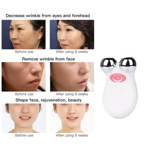 EMS Face Lifting Microcurrent Roller Massager Portable Anti Wrinkle Facial Skin Tightening Slimming Machine Cellulite Massage