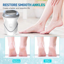 Load image into Gallery viewer, Portable Electric Vacuum Adsorption Foot Grinder Electronic Foot File Pedicure Tools Callus Remover Feet Care Sander
