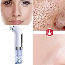 Load image into Gallery viewer, Small Bubble Blackhead Remover Vacuum Nose Pore Cleaner with USB Rechargeable
