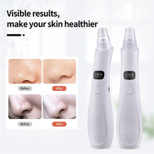 Load image into Gallery viewer, Blackhead Remover Face Nose Deep Cleaner Pore Acne Pimple Removal Vacuum Suction Facial Diamond Beauty Clean Skin Tool
