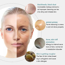 Load image into Gallery viewer, Electric Facial Cleansing Brush EMS lifting And Introduction Massager Blackhead Removal And Pore Beauty Instrument Facial Skin

