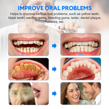 Load image into Gallery viewer, Ultrasonic Dental Scaler Teeth Tartar Calculus Remover High Quality Teeth Whitening Electric Sonic Teeth Cleaner
