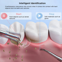 Load image into Gallery viewer, Ultrasonic Dental Tartar Cleaner Electric Tooth Polisher Tartar Eliminator Teeth Whitening Dental Calculus Plaque Tartar Remover

