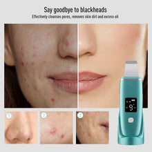 Load image into Gallery viewer, Ultrasonic Skin Scrubber EMS Facial Pore Deep Cleansing Spatula Blackhead Dead Skin Remover Acne Extractor Face Lifting Massager
