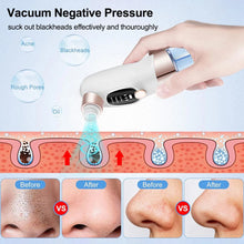 Load image into Gallery viewer, Electric Blackhead Remover Pore Vacuum Cleaner Facial Black Dots Vacuum Cleaner Pimple Acne Blackhead Removal Black Dots Remover
