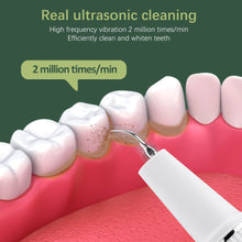 Load image into Gallery viewer, Visual Electric Dental Scaler Ultrasonic Teeth Whitening Tooth Cleaner Calculus Remover With Camera Irrigator Tartar Eliminator
