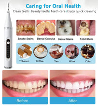 Load image into Gallery viewer, Ultrasonic Dental Scaler Electric Teeth Cleaning Tools Clean Tartar Smoke Stains Adult Oral 5 Mode Cleaning Care Tools
