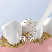 Load image into Gallery viewer, Electric Teeth Whitening Dental Calculus Scaler Plaque Coffee Stain Tartar Removal High Frequency Sonic Toothbrush Teeth Cleaner
