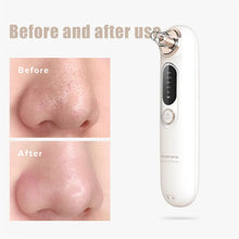 Load image into Gallery viewer, Electric Pore Nose Cleaner Portable Mini Facial Whitehead Blackhead Remover Vacuum Machine Deep Face Cleaning Tool
