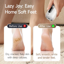 Load image into Gallery viewer, Rechargeable Electric Foot Grinder Callus Remover Thick Leather Polishing Foot Dead Skin  Grinder Pedicure Personal Care Tools
