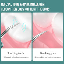 Load image into Gallery viewer, Visual Ultrasonic Dental Scaler For Teeth Tartar Stain Tooth Calculus Remover Electric Sonic Teeth Plaque Cleaner
