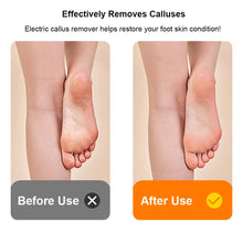 Load image into Gallery viewer, Electric Foot Grinder Mini Portable Foot Callus Remover USB Rechargeable Foot Exfoliation Predicure Grinding Dead Skin Remover
