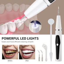 Load image into Gallery viewer, Ultrasonic Dental Scaler Electric Teeth Cleaner Calculus Remover Tartar Eliminator Toothpicks Teeth Whitening Dentistry Tools
