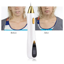 Load image into Gallery viewer, Mole Removal Pen Sweep Spot Wart Corn Dark Remover LCD Professional 9 Speed Skin Care Salon Beauty Tool
