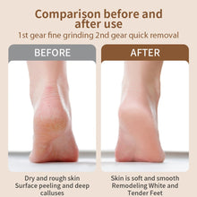Load image into Gallery viewer, Electric Foot Grinder for Feet Heels Care Automatic Foot Exfoliator File Polish Nails Pedicure Machine Callus Dead Skin Remove
