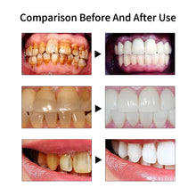 Load image into Gallery viewer, Ultrasonic Dental Scaler Electric Teeth Cleaner Calculus Remover Tartar Eliminator Toothpicks Teeth Whitening Dentistry Tools
