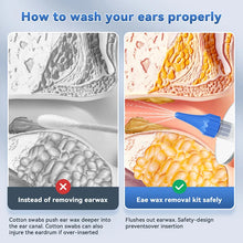 Load image into Gallery viewer, Ear Wax Removal Tool Manual Ear Irrigation Flushing System Safe And Effective Ear Cleaner For Adults Kids Cleaning Washer Kit
