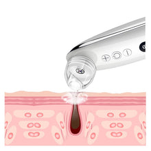 Load image into Gallery viewer, Visual Blackhead Vacuum Kit With Charging Base HD Camera 6-Level Skin Deep Cleaning Black Spots Strong Vacuum Suction
