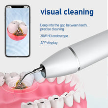 Load image into Gallery viewer, Ultrasonic Dental Scaler Electric Teeth Cleaner for Tooth Whitening Sonic Stone Plaque Scalers Tartar Stains Calculus Remover
