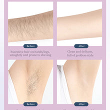 Load image into Gallery viewer, Hair Removal Bikini Epilator Rechargeable Razor Women Underarms Shaver Legs Armpit Hair Foot Callus Remover
