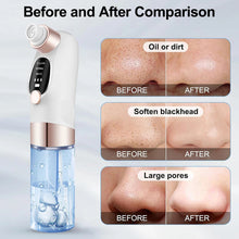 Load image into Gallery viewer, Electric Blackhead Remover Pore Vacuum Cleaner Facial Black Dots Vacuum Cleaner Pimple Acne Blackhead Removal Black Dots Remover
