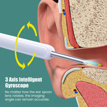 Load image into Gallery viewer, Smart Visual Earpick Ear Wax Removal Tool Endoscope Spoon 1296P HD Ear Cleaner with 6 LED Lights 3.6mm Mini Visual Ear Camera
