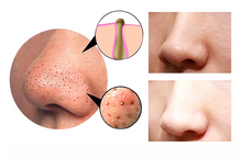 Load image into Gallery viewer, 4 in 1 Body Guasha Cupping Blackhead Remover Machine

