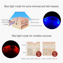 Load image into Gallery viewer, Infrared LED Light Photon Therapy V-Shape Face Massager
