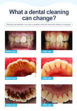 Load image into Gallery viewer, Visual Ultrasonic Tooth Cleaning Device Household
