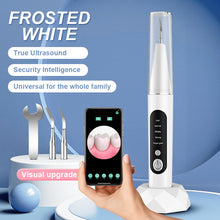 Load image into Gallery viewer, Visual Ultrasonic Tooth Cleaning Device Household
