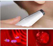 Load image into Gallery viewer, Mosquito Antipruritic Device Quick Antipruritic Device Pen
