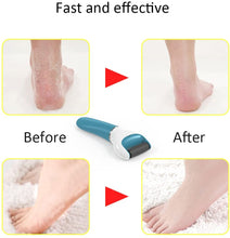 Load image into Gallery viewer, Electric USB Rechargeable Foot Grinder Heel File Grinding
