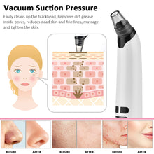 Load image into Gallery viewer, Blackhead Remover USB Facial Cleansing Pore Acne Remover
