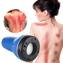 Load image into Gallery viewer, Electric Guasha Massager Scraping Tool Fat Burner Body Slimming Vacuum Cans Cupping Body Massage Negative Pressure Suction Cups

