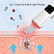 Load image into Gallery viewer, Ultrasonic Skin Scrubber Deep Cleaning Face Scrubber
