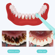 Load image into Gallery viewer, Ultrasonic Dental Washer Portable Dental Scaler USB Rechargeable Dental Calculus Remover for Tartar Clean Teeth Whitening
