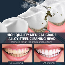 Load image into Gallery viewer, Electric Dental Scaler Teeth Whitening Device Teeth Cleaner
