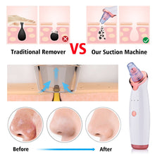 Load image into Gallery viewer, Facial Blackhead Remover Electric Acne Cleaner Blackhead Black Point Vacuum Cleaner Tool Black Spots Pore Cleaner Machine
