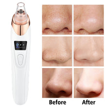 Load image into Gallery viewer, Electric Vacuum Suction Blackhead Remover Face Pore Vacuum Acne Pore Cleaner Pimple Removal Facial Skin Care Tools
