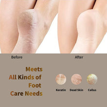 Load image into Gallery viewer, Electric Pedicure Foot File Callus Remover Grinder USB
