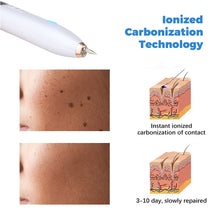 Load image into Gallery viewer, Mole Spot Scanning Pen Needle Light LED Screen 9-speed Tattoo Removal Plasma Pen Beauty Instrument
