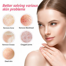 Load image into Gallery viewer, Facial Blackhead Remover Electric Acne Cleaner Device

